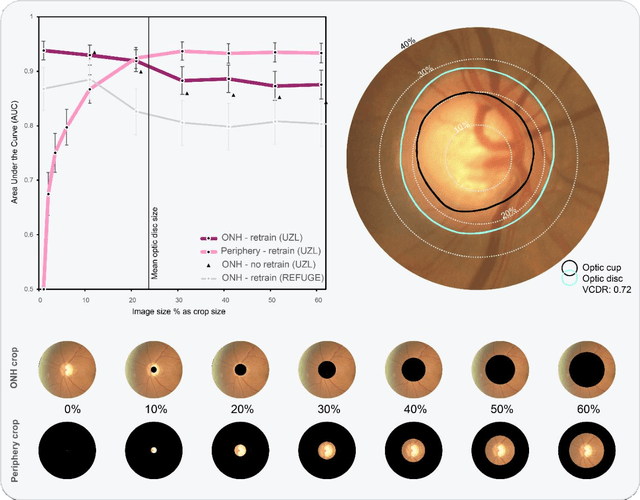 Figure 4 for Glaucoma detection beyond the optic disc: The importance of the peripapillary region using explainable deep learning