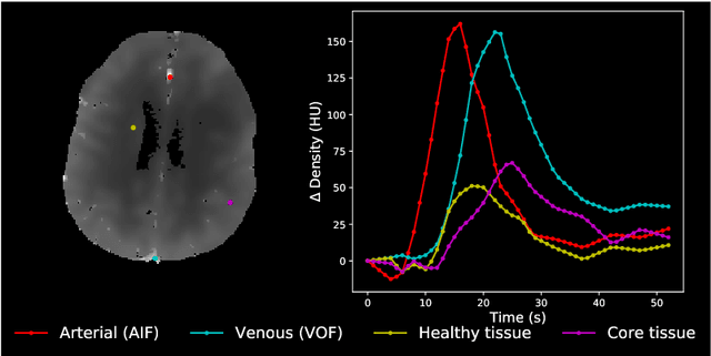 Figure 1 for AIFNet: Automatic Vascular Function Estimation for Perfusion Analysis Using Deep Learning