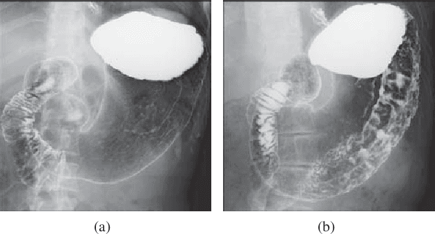 Figure 1 for Soft-Label Anonymous Gastric X-ray Image Distillation