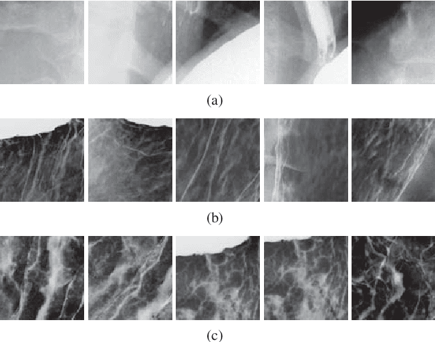 Figure 3 for Soft-Label Anonymous Gastric X-ray Image Distillation