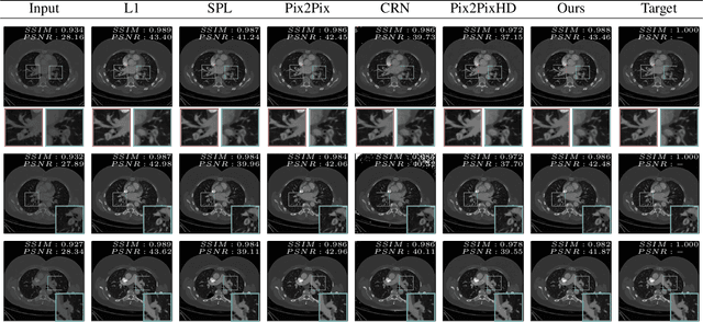 Figure 3 for Prediction of low-keV monochromatic images from polyenergetic CT scans for improved automatic detection of pulmonary embolism
