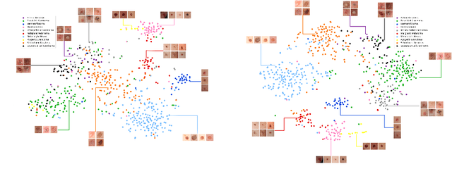 Figure 1 for Webly Supervised Learning for Skin Lesion Classification