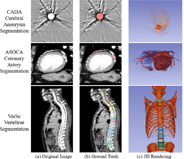 Figure 4 for Cutting-edge 3D Medical Image Segmentation Methods in 2020: Are Happy Families All Alike?