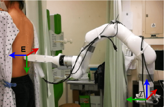 Figure 1 for Ultrasound-Guided Assistive Robots for Scoliosis Assessment with Optimization-based Control and Variable Impedance