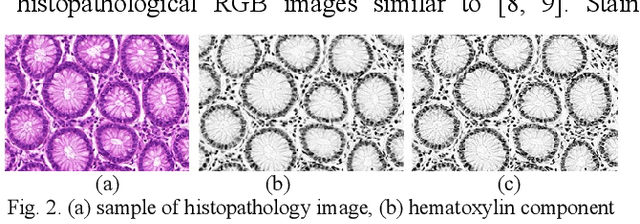 Figure 3 for Gland Segmentation in Histopathological Images by Deep Neural Network