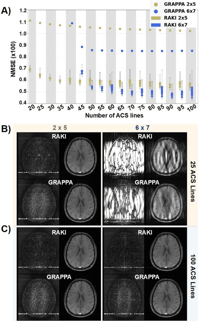 Figure 3 for Iterative RAKI with Complex-Valued Convolution for Improved Image Reconstruction with Limited Scan-Specific Training Samples