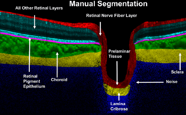 Figure 1 for A Deep Learning Approach to Digitally Stain Optical Coherence Tomography Images of the Optic Nerve Head