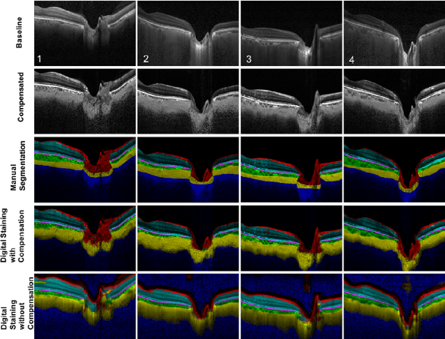 Figure 3 for A Deep Learning Approach to Digitally Stain Optical Coherence Tomography Images of the Optic Nerve Head