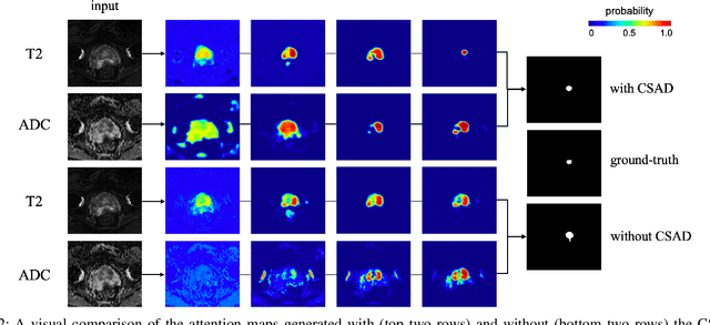 Figure 2 for Cross-Modal Self-Attention Distillation for Prostate Cancer Segmentation