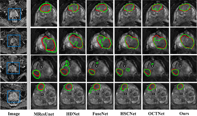 Figure 3 for Cross-Modal Self-Attention Distillation for Prostate Cancer Segmentation