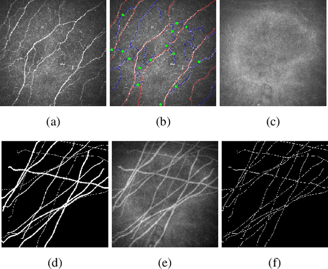 Figure 1 for A Spatially Constrained Deep Convolutional Neural Network for Nerve Fiber Segmentation in Corneal Confocal Microscopic Images using Inaccurate Annotations