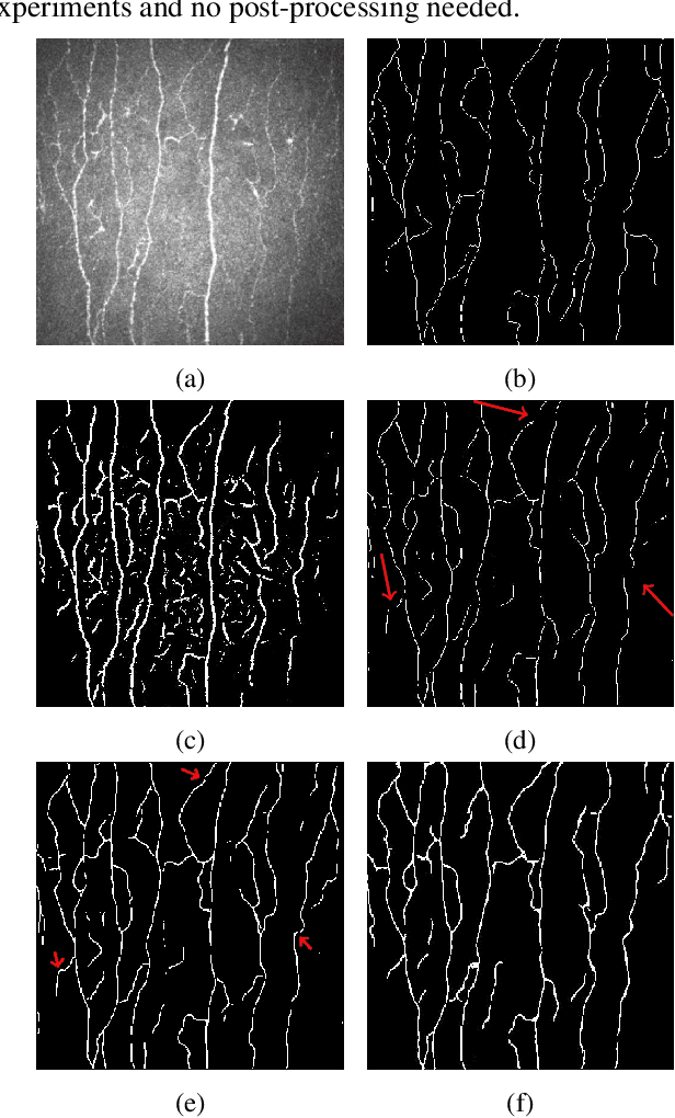 Figure 3 for A Spatially Constrained Deep Convolutional Neural Network for Nerve Fiber Segmentation in Corneal Confocal Microscopic Images using Inaccurate Annotations