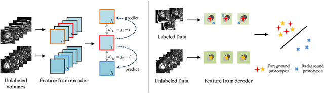 Figure 1 for Bootstrap Representation Learning for Segmentation on Medical Volumes and Sequences