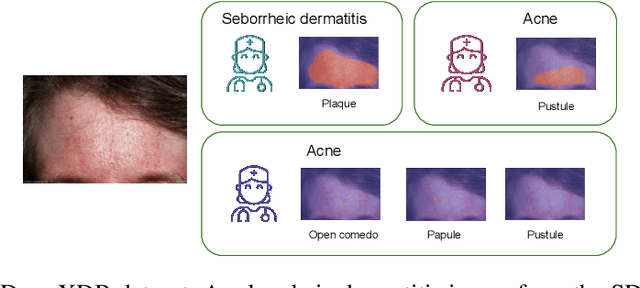 Figure 3 for DermX: an end-to-end framework for explainable automated dermatological diagnosis