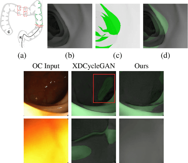 Figure 1 for Visualizing Missing Surfaces In Colonoscopy Videos using Shared Latent Space Representations