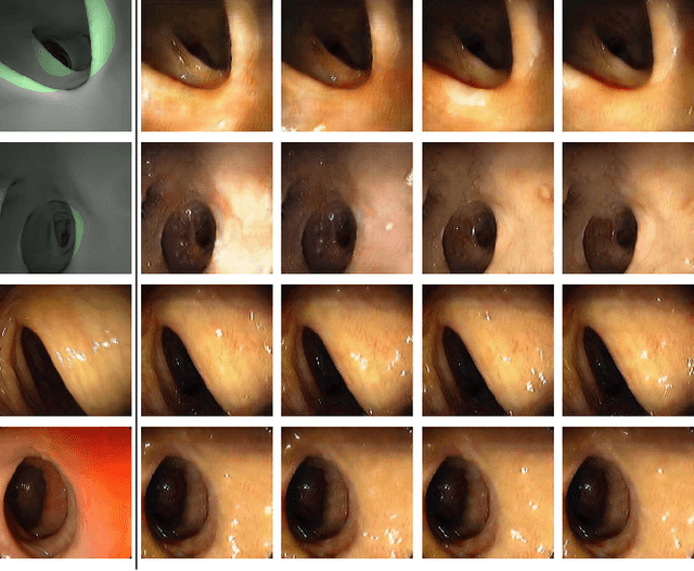 Figure 4 for Visualizing Missing Surfaces In Colonoscopy Videos using Shared Latent Space Representations