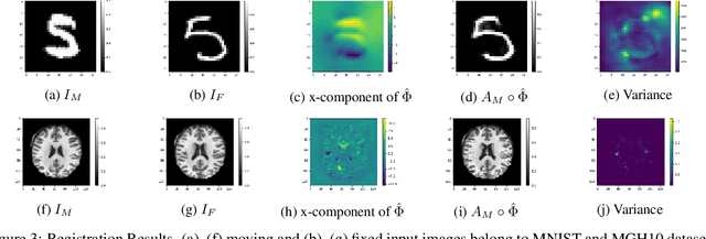 Figure 4 for Unsupervised Deep-Learning Based Deformable Image Registration: A Bayesian Framework