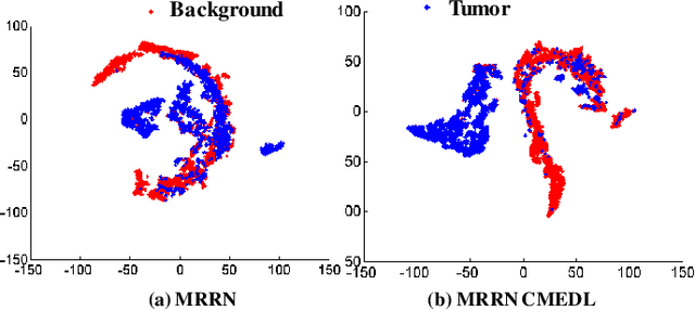 Figure 3 for Unpaired cross-modality educed distillation (CMEDL) applied to CT lung tumor segmentation
