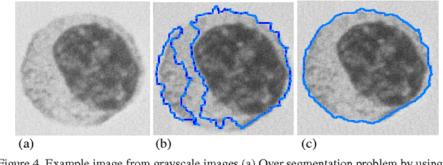 Figure 4 for A Novel Image Segmentation Enhancement Technique based on Active Contour and Topological Alignments