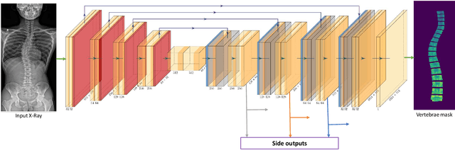 Figure 2 for Analysis of Scoliosis From Spinal X-Ray Images