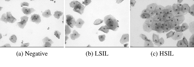 Figure 1 for A New Cervical Cytology Dataset for Nucleus Detection and Image Classification (Cervix93) and Methods for Cervical Nucleus Detection