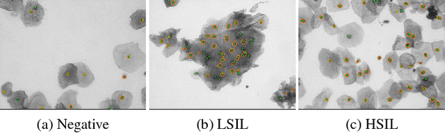 Figure 4 for A New Cervical Cytology Dataset for Nucleus Detection and Image Classification (Cervix93) and Methods for Cervical Nucleus Detection