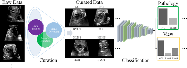 Figure 1 for Automated Detection of Congenital HeartDisease in Fetal Ultrasound Screening