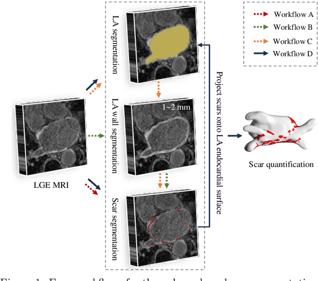 Figure 1 for AtrialJSQnet: A New Framework for Joint Segmentation and Quantification of Left Atrium and Scars Incorporating Spatial and Shape Information