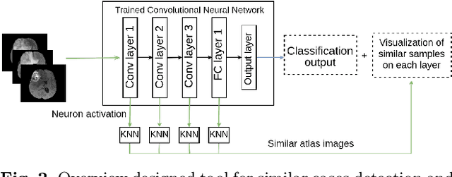 Figure 3 for Improving a neural network model by explanation-guided training for glioma classification based on MRI data