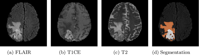 Figure 4 for 3D Semantic Segmentation of Brain Tumor for Overall Survival Prediction