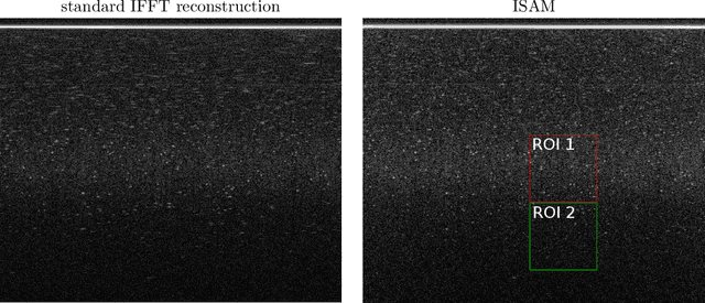 Figure 3 for Simultaneous reconstruction and displacement estimation for spectral-domain optical coherence elastography