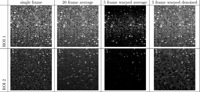 Figure 4 for Simultaneous reconstruction and displacement estimation for spectral-domain optical coherence elastography