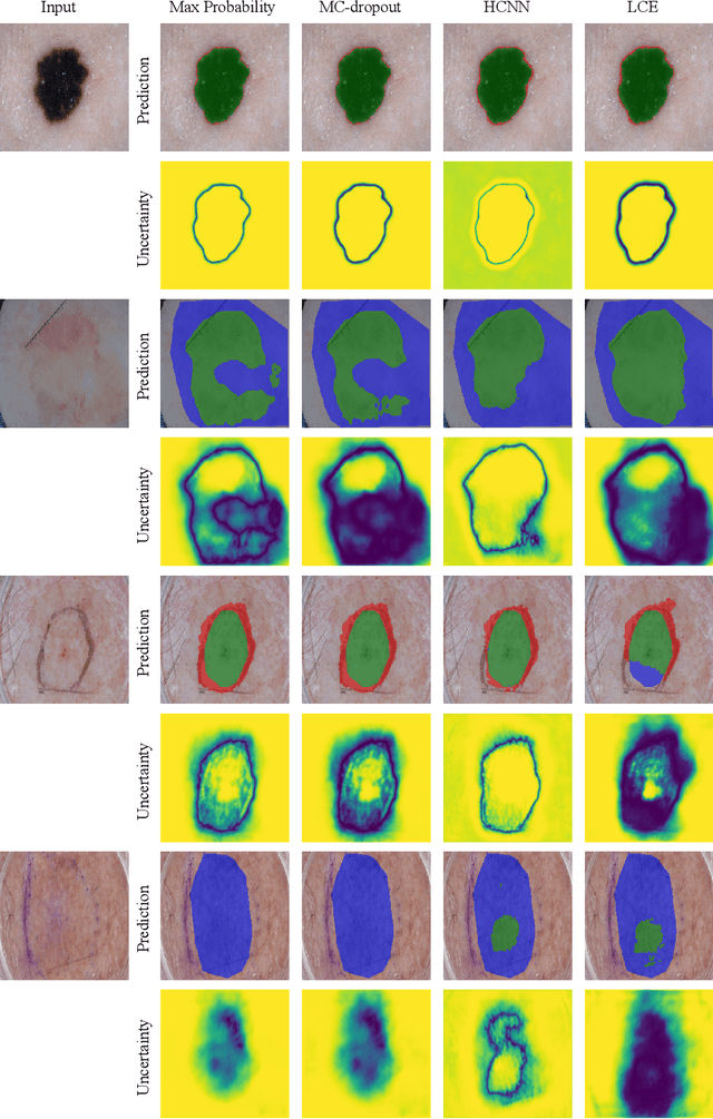 Figure 3 for Leveraging Uncertainty Estimates for Predicting Segmentation Quality