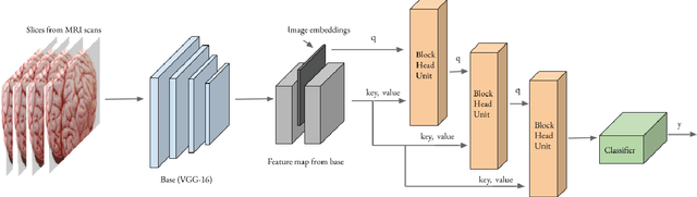 Figure 3 for Preclinical Stage Alzheimer's Disease Detection Using Magnetic Resonance Image Scans