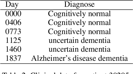 Figure 4 for Preclinical Stage Alzheimer's Disease Detection Using Magnetic Resonance Image Scans