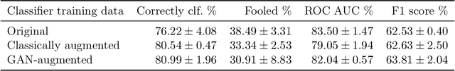 Figure 4 for Adversarial Augmentation for Enhancing Classification of Mammography Images