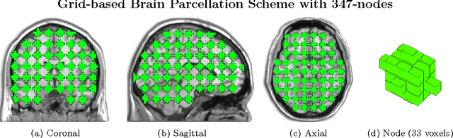 Figure 1 for Disease Prediction based on Functional Connectomes using a Scalable and Spatially-Informed Support Vector Machine