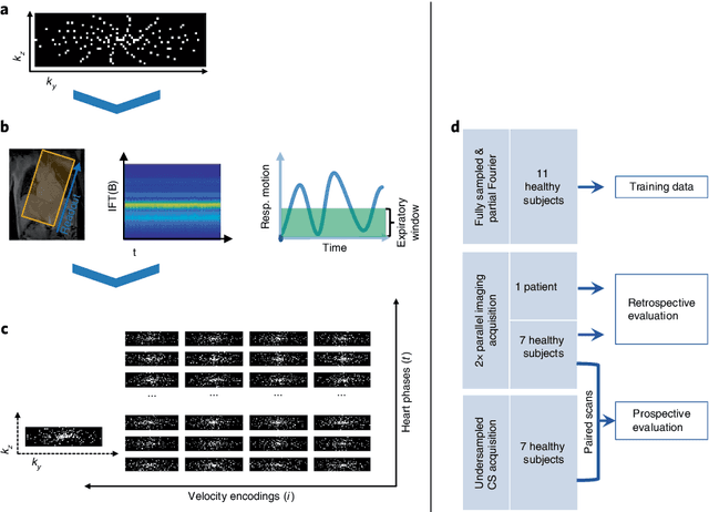 Figure 1 for Deep variational network for rapid 4D flow MRI reconstruction