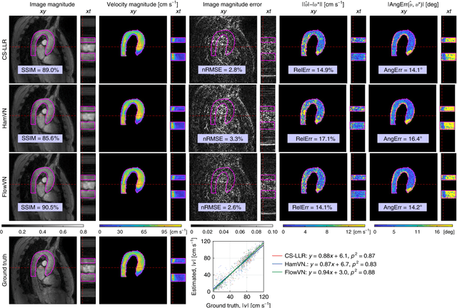 Figure 4 for Deep variational network for rapid 4D flow MRI reconstruction