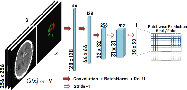 Figure 3 for Lesion Conditional Image Generation for Improved Segmentation of Intracranial Hemorrhage from CT Images