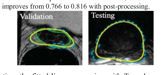 Figure 3 for Prostate Segmentation from 3D MRI Using a Two-Stage Model and Variable-Input Based Uncertainty Measure