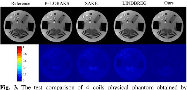Figure 3 for Universal Generative Modeling for Calibration-free Parallel Mr Imaging