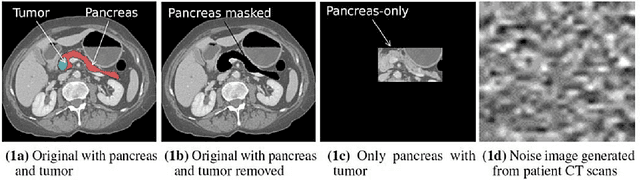 Figure 1 for Detecting Spurious Correlations with Sanity Tests for Artificial Intelligence Guided Radiology Systems