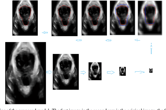 Figure 2 for Segmentation of Levator Hiatus Using Multi-Scale Local Region Active contours and Boundary Shape Similarity Constraint
