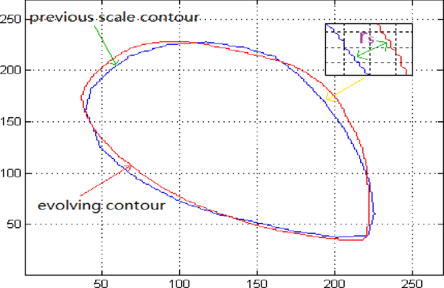 Figure 4 for Segmentation of Levator Hiatus Using Multi-Scale Local Region Active contours and Boundary Shape Similarity Constraint