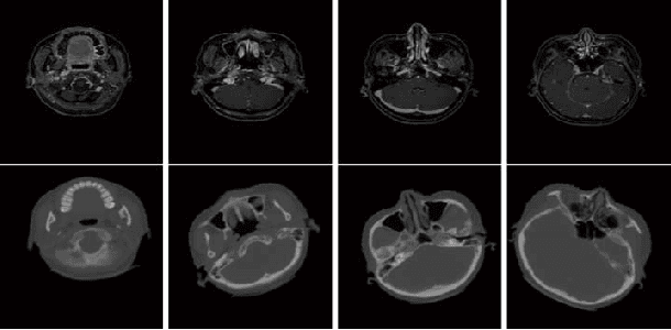 Figure 1 for Robust Multimodal Image Registration Using Deep Recurrent Reinforcement Learning