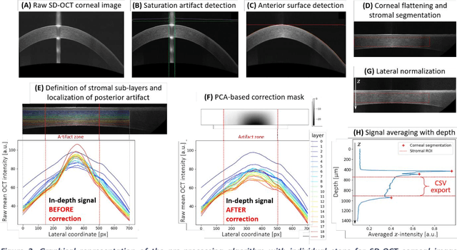 Figure 3 for Objective assessment of corneal transparency in the clinical setting with standard SD-OCT devices