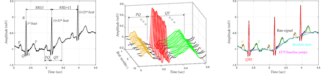 Figure 1 for ECG Beat Representation and Delineation by means of Variable Projection