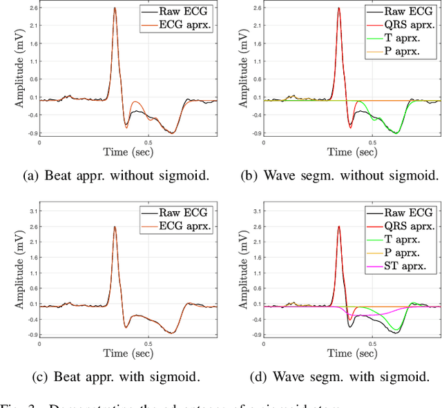 Figure 3 for ECG Beat Representation and Delineation by means of Variable Projection