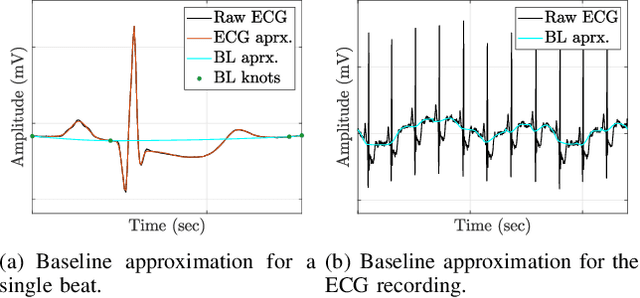 Figure 4 for ECG Beat Representation and Delineation by means of Variable Projection